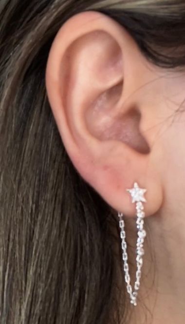 ARETE STAR
