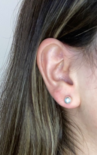 ARETE TOPITO